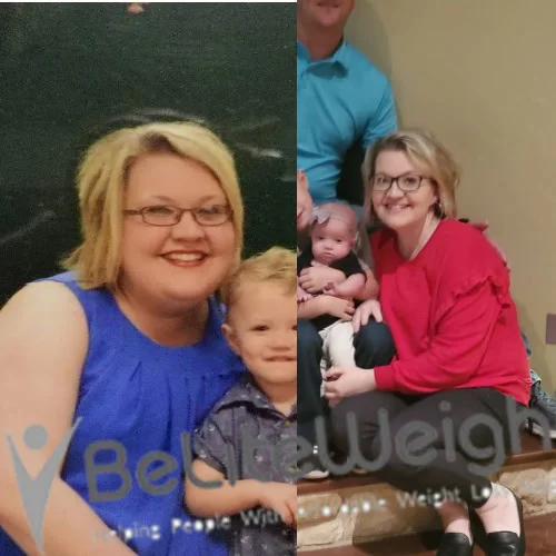 Weight Loss Surgery Before And After Amy S - 4 Year Update*
